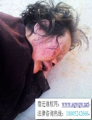 8旬老太遭村支书妻子毒打灌尿 支书已被停职(组图1)