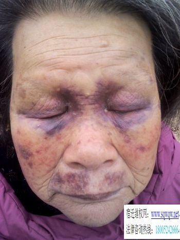 8旬老太遭村支书妻子毒打灌尿 支书已被停职(图3)